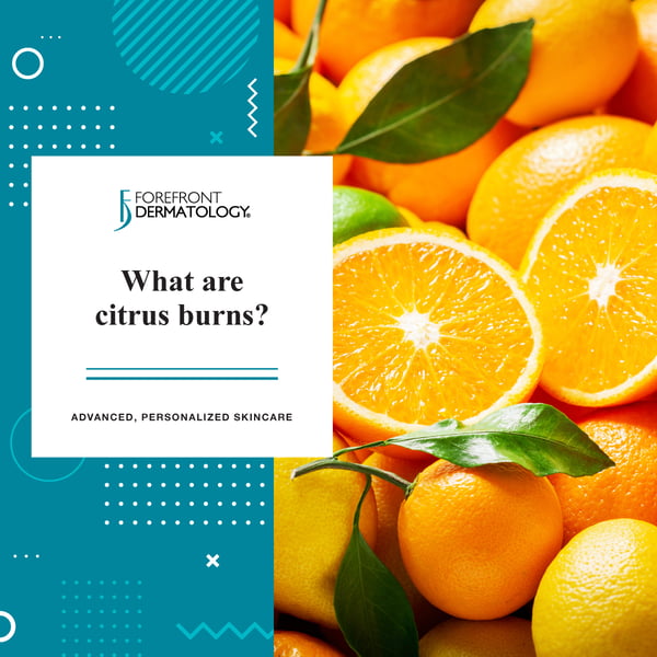 CitrusBurn